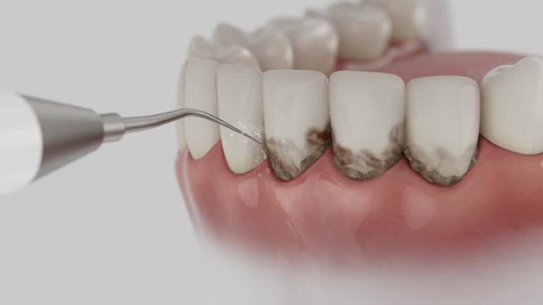 Trusted Root Canal Treatment service in North Potomac, MD - Dentist Open Now